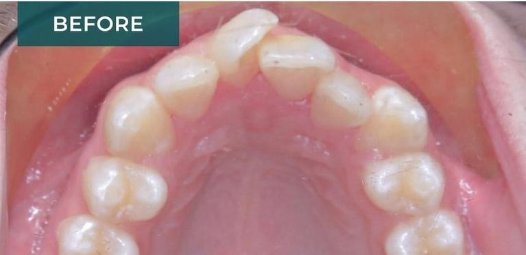 Orthodontics-Before-Image