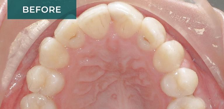 Orthodontics-Before-Image